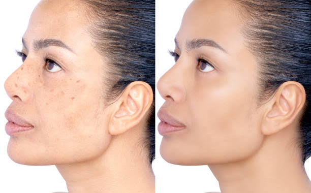 Korean Pure Collagen Masks