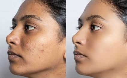 Korean Pure Collagen Masks